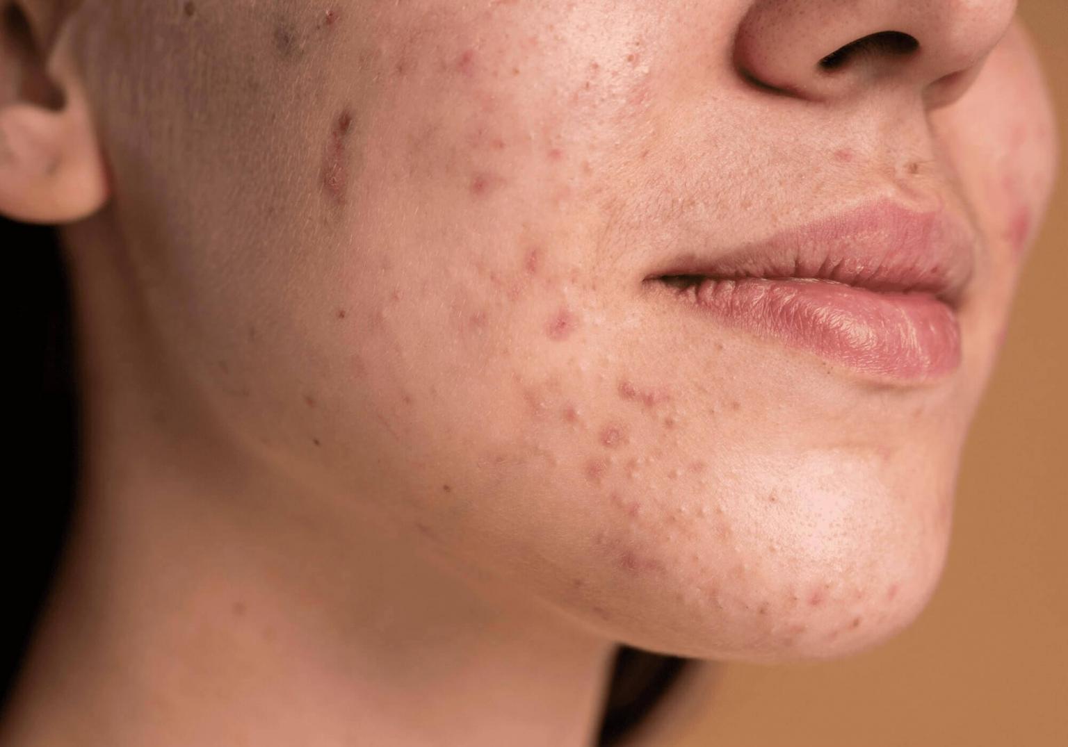 Rosto de mulher com destaque em cravos